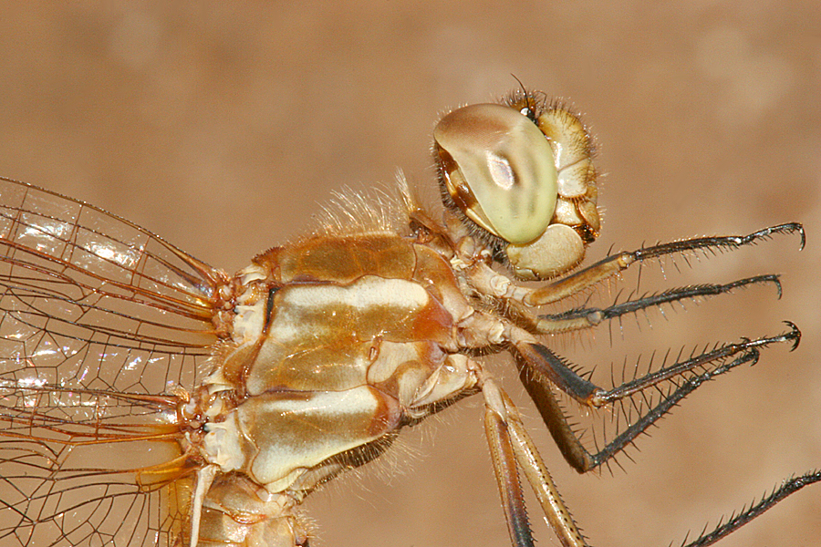 lateral view of Thorax